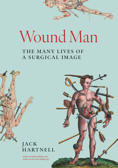 Book cover for Wound Man: The Many Lives of a Surgical Image